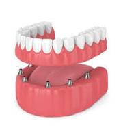 Dental clinic in chennai