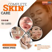 Melasma Treatment in kurnool
