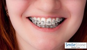 Best Dentist in Nagpur  