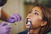 emergency dental service in HSR Layout - Chethanshivaram.com