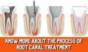 The Dental Studio Siripuram| Dental Invisalign Treatment Siripuram | B