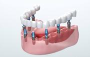 Best Dental Clinic Visakhapatnam  - The Dental Studio
