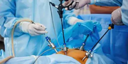 Best Laparoscopic Surgery  in  Chengalpattu