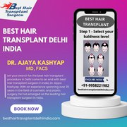 Best Hair Transplant Delhi 