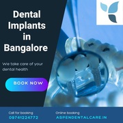 Dental Implants in Bangalore | Aspen Dental Care