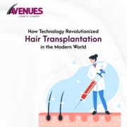 Best Hair Transplant in Ahmedabad,  Avenues Cosmetic.