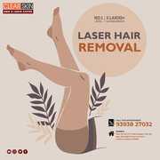 Stretch Marks Laser Treatment In hyderabad