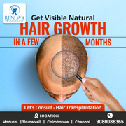 Best Hair Fall Treatment in Madurai