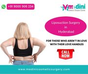 Rhinoplasty Cost in Hyderabad