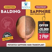 Book a consultation with our hair transplantation experts in Renew 