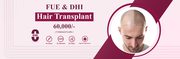 Hair transplant cost