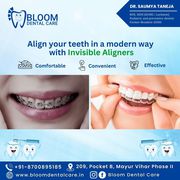 Dental Fillings in Mayur Vihar- Bloomdentalcare