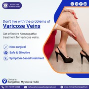 Homeopathic Medicine & Treatments for Varicose Veins