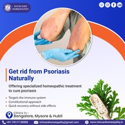 Psoriatic Arthritis Treatment | Psoriatic Scalp Treatment