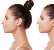 Best Nose Reshaping in Bhubaneswar