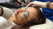 Fractional Co2 Laser in Delhi Ncr