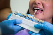 Porcelain Veneers at Best Price – Safe & Aesthetic Solution