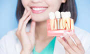 Dental Implant Surgery Treatment in Gangapur Road,  Nashik