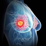 Expert Breast Cancer Surgery – Advanced Care,  Trusted Surgeons,  Faste