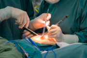 General Surgeries: A Wide Range of Expertise of Dr. Naveen Solanki