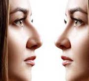 Best Rhinoplasty Doctor in Bhubaneswar, Odisha