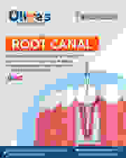 What Causes Tooth Infection Requiring Root Canal Treatment?