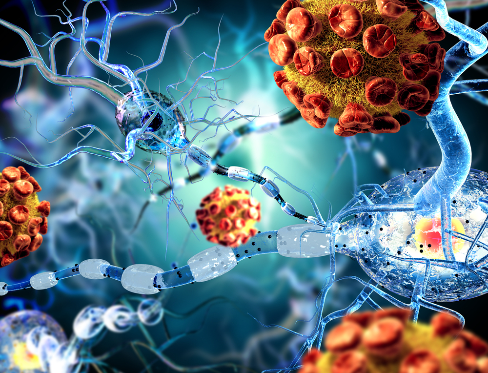 Neurologist in Vijayawada | Best Neurologist in Vijayawada